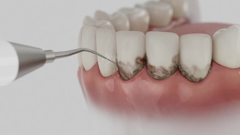Trusted Teeth Cleaning And Checkup service in East Brady, PA - Dentist Open Now